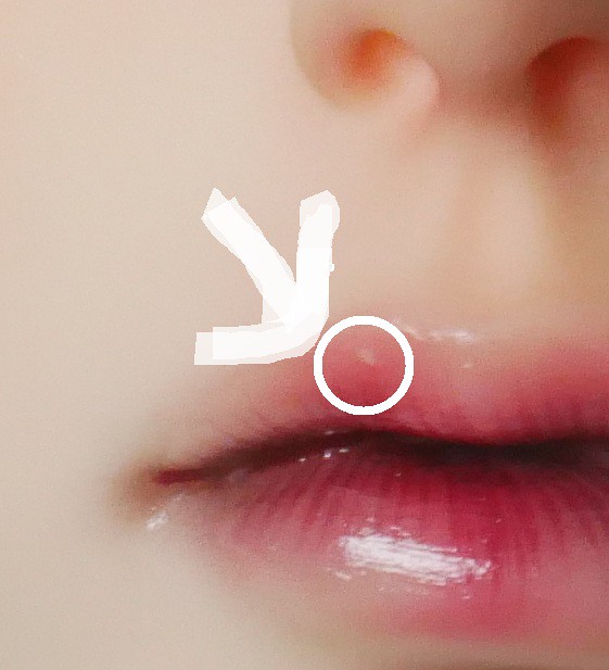 [​IMG]